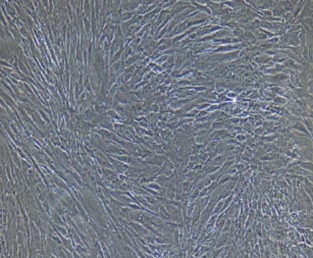 Human Primary Esophageal Fibroblasts Cells