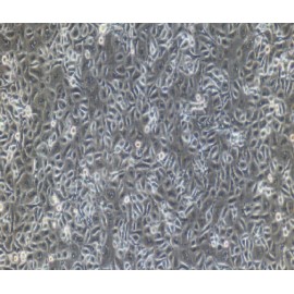 Human Primary Gastric Mucosal Epithelial Cells