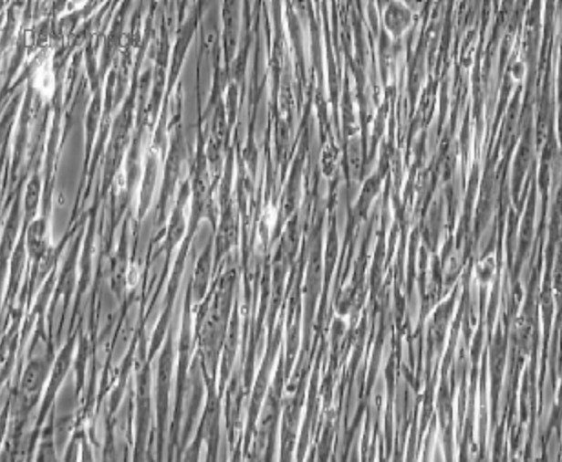 Human Primary Gastric Smooth Muscle Cells