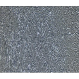 Human Primary Gastric Fibroblasts Cells