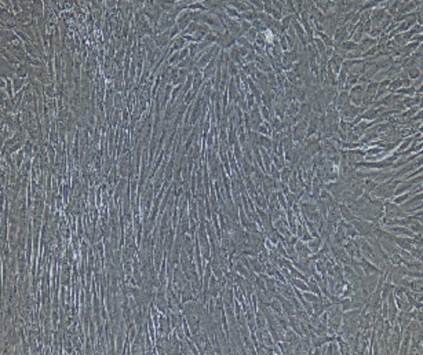 Human Primary Gastric Fibroblasts Cells