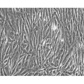 Human Primary Small Intestinal Mucosal Epithelial Cells