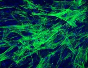 Human Primary Small Intestinal Smooth Muscle Cells