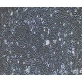 Human Primary Small Intestinal Fibroblasts Cells
