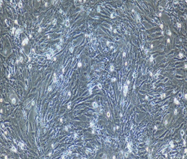 Human Primary Colon Smooth Muscle Cells