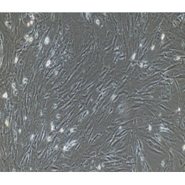Human Primary Colon Fibroblasts Cells
