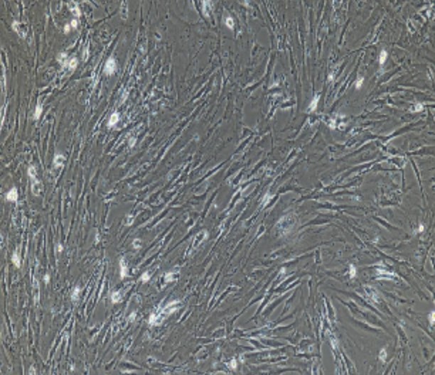 Human Primary Colon Fibroblasts Cells