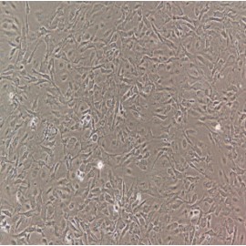 Human Primary Sinusoidal Endothelial Cells
