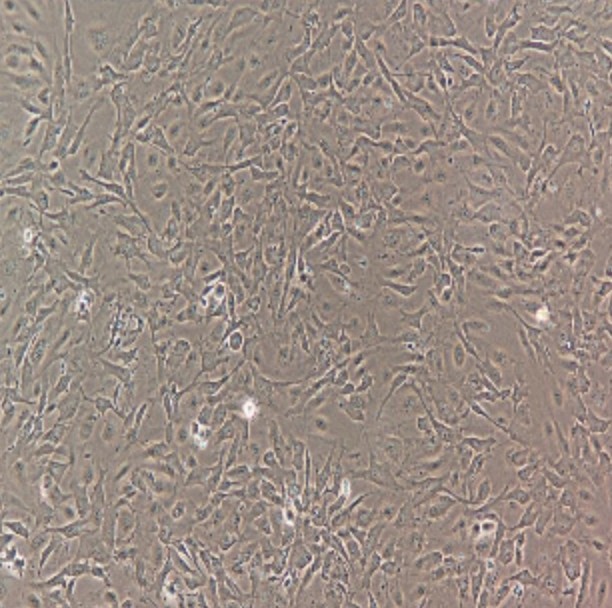 Human Primary Sinusoidal Endothelial Cells