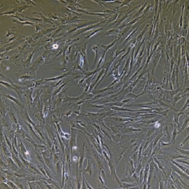 Human Primary Rectal Fibroblasts Cells