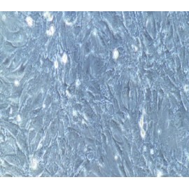 Human Primary Glomerular Mesangial Cells