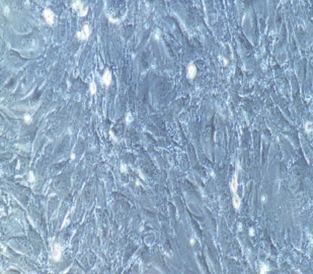 Human Primary Glomerular Mesangial Cells