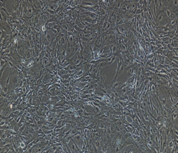 Human Primary Glomerular Endothelial Cells