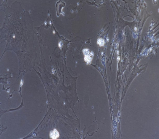 Human Primary Kidney Foot Cells