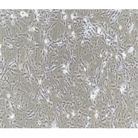 Human Primary Ureteral Epithelial Cells