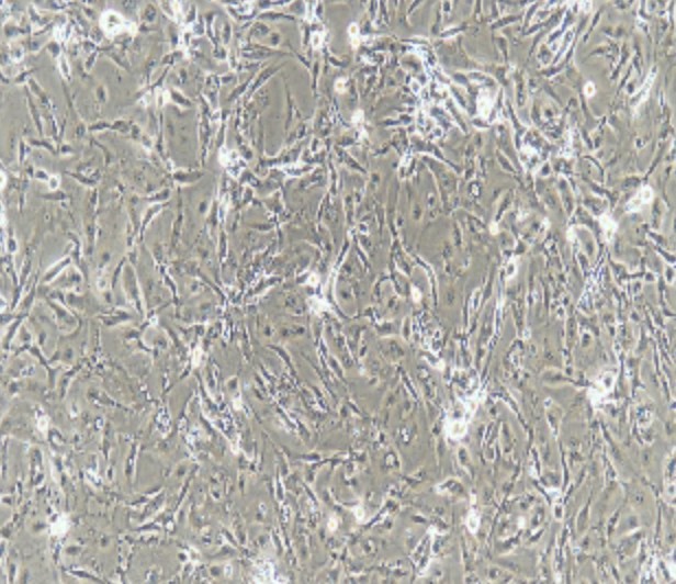Human Primary Ureteral Epithelial Cells