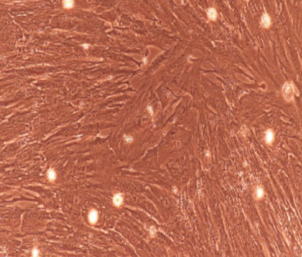 Human Primary Ureteral Smooth Muscle Cells