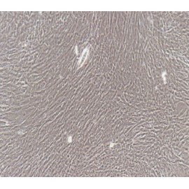 Human Primary Bladder Smooth Muscle Cells
