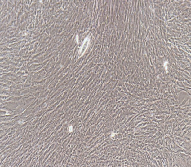 Human Primary Bladder Smooth Muscle Cells