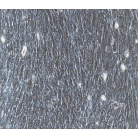 Human Primary Bladder Fibroblasts Cells