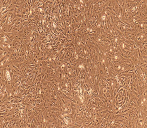 Human Primary Prostatic Epithelial Cells