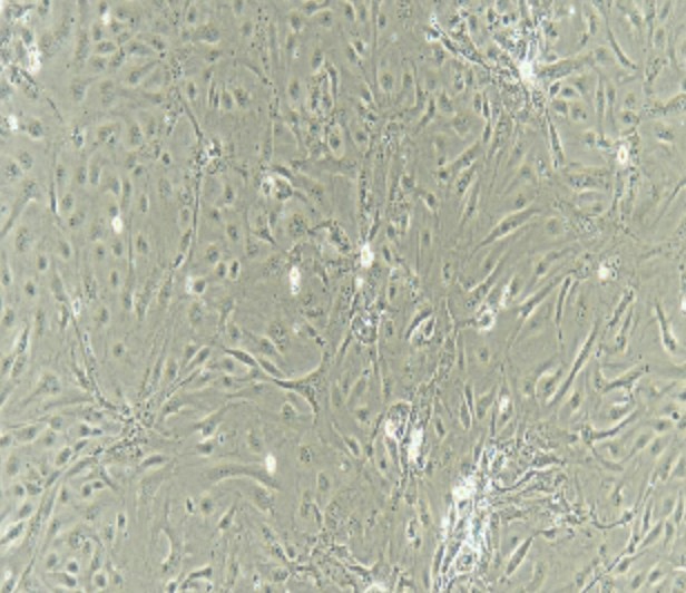 Human Primary Thyroid Epithelial Cells