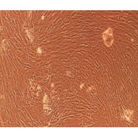 Human Primary Thyroid Fibroblasts Cells