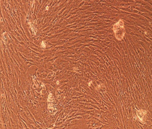 Human Primary Thyroid Fibroblasts Cells
