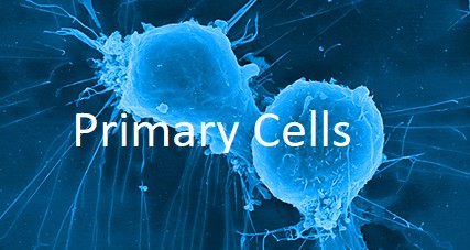 Human Primary Pancreatic Stellate Cells