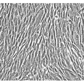 Human Primary Prostatic Fibroblasts Cells