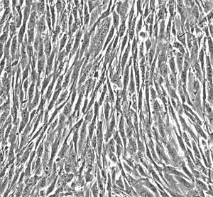 Human Primary Prostatic Fibroblasts Cells