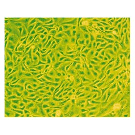 Human Primary Fallopian Tube Fibroblasts Cells