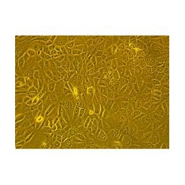 Human Primary Esophageal Fibroblasts Cells