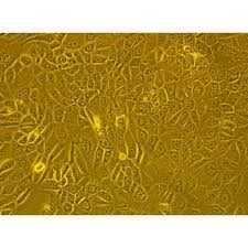 Human Primary Esophageal Fibroblasts Cells