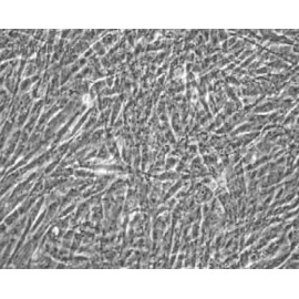 Human Primary Oviduct Epithelial Cells