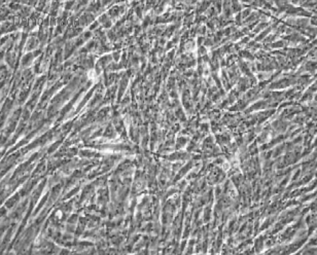 Human Primary Oviduct Epithelial Cells