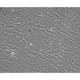 Human Primary Oviduct Smooth Muscle Cells