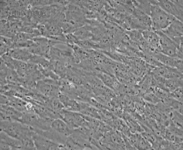 Human Primary Oviduct Smooth Muscle Cells