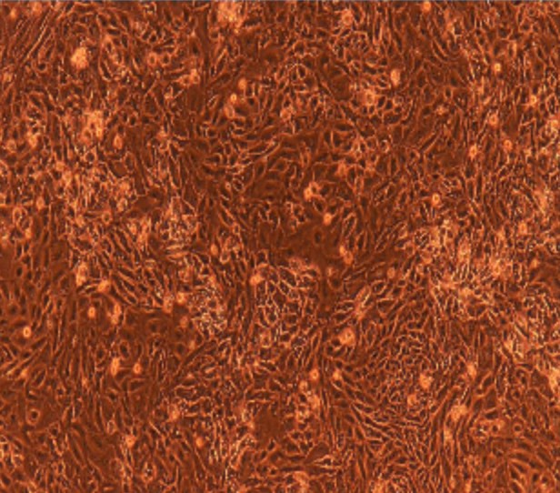 Human Primary Endometrial Epithelial Cells