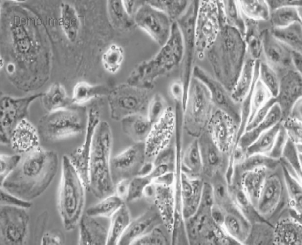 Human Primary Mammary Epithelial Cells