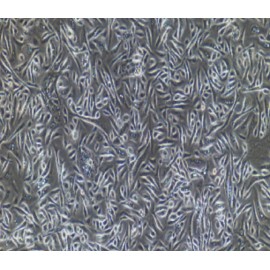 Human Primary Mammary Ductal Epithelial Cells