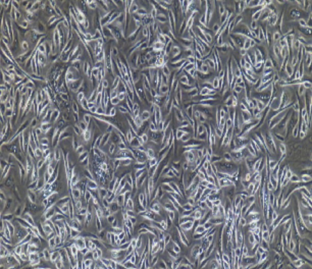 Human Primary Mammary Ductal Epithelial Cells