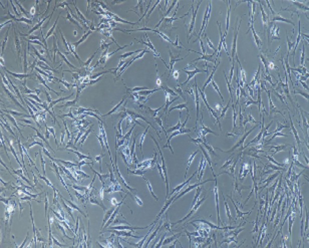 Human Primary Dermal Fibroblasts Cells