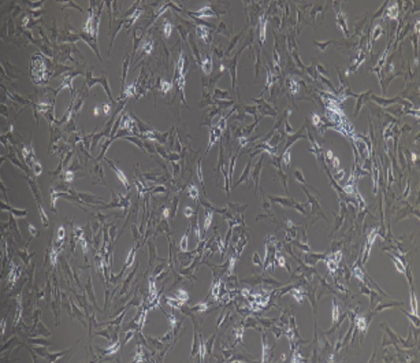 Human Primary Preadipocyte Cells