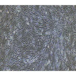 Human Primary Adipose Microvascular Endothelial Cells