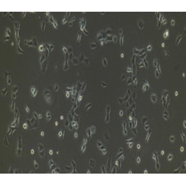 Human Primary Hair Follicular Keratinocytes Cells