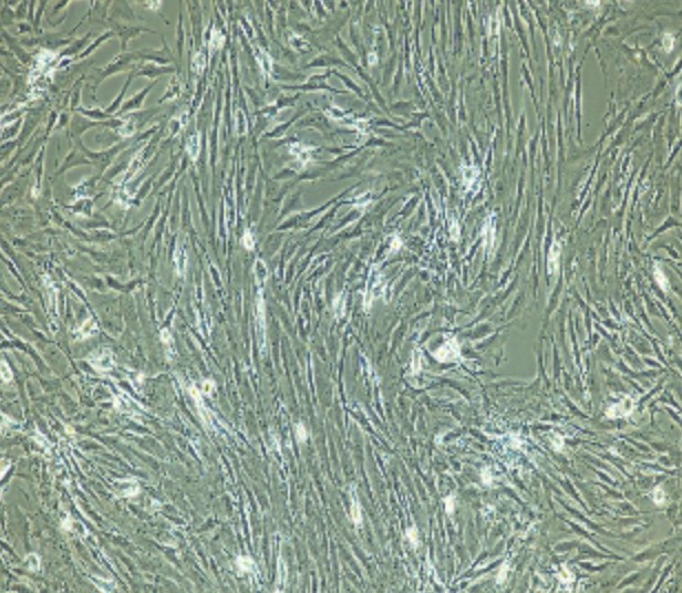 Human Primary Ligament Fibroblasts Cells