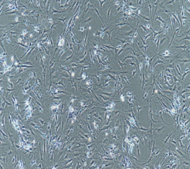 Human Primary Rheumatoid Arthritis Synovial Fibroblasts Cells