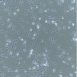 Human Primary Synovial Fibroblasts Cells