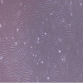 Human Primary Bone Marrow Mesenchymal Stem Cells